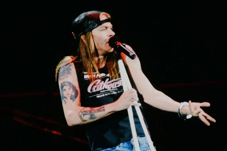 axl rose with long hair and a backward cap, holding a microphone and gesturing to the audience during a live performance.